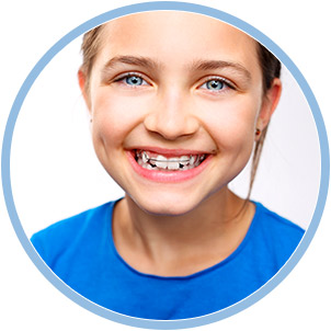 orthodontic retention